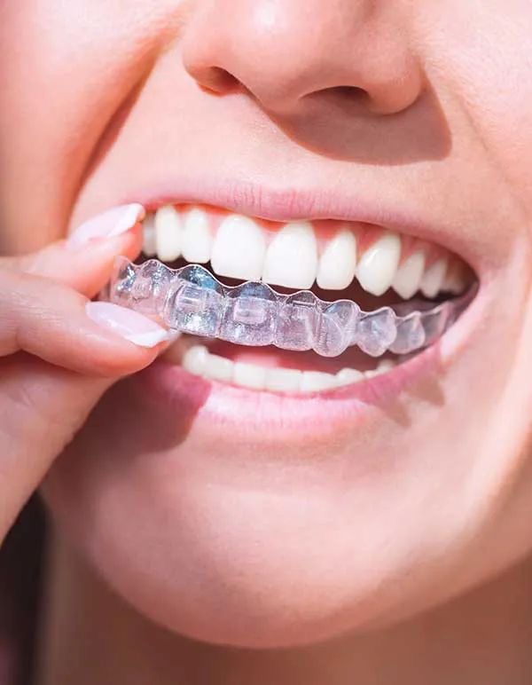 Woman smiling with clear aligner